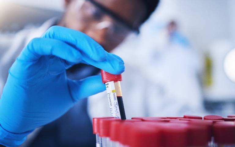 Blood test could predict Parkinson’s seven years before symptoms