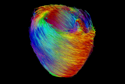 Colourful computer image of heart muscle fibres