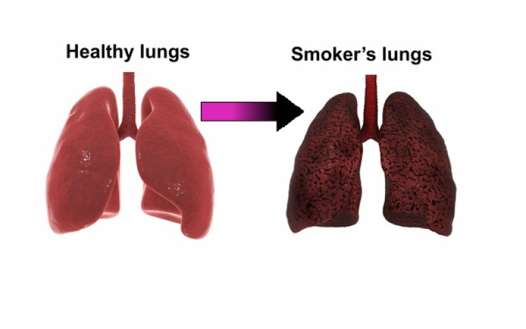 Why does smoking make your lungs go black?