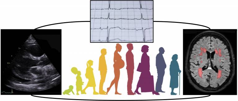 Example of echocardiography, ECG trace and brain MRI with cerebrovascular lesions surrounding the logo of the MRC LHA unit that presents a human being at different stages of their life