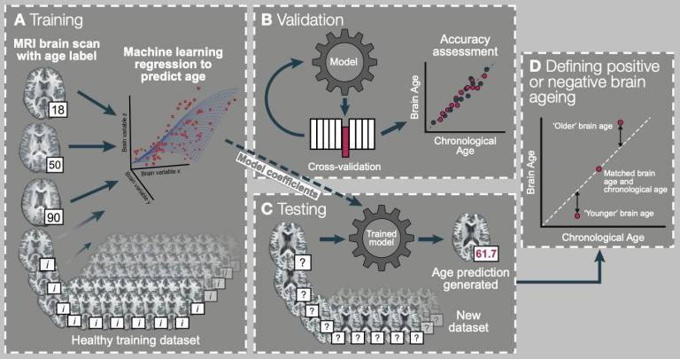 Neuroimaging and neurochemical ageing biomarkers for optimising prognosis in motor neurone disease