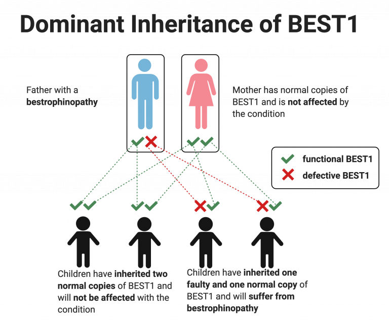 what is the best definition of dominant trait
