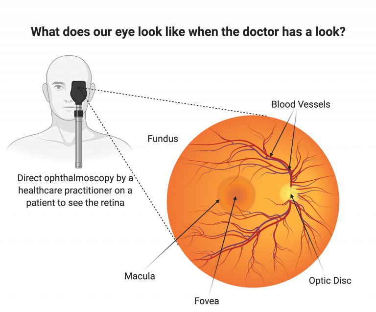 The retina and retinal pigment epithelium (RPE)
