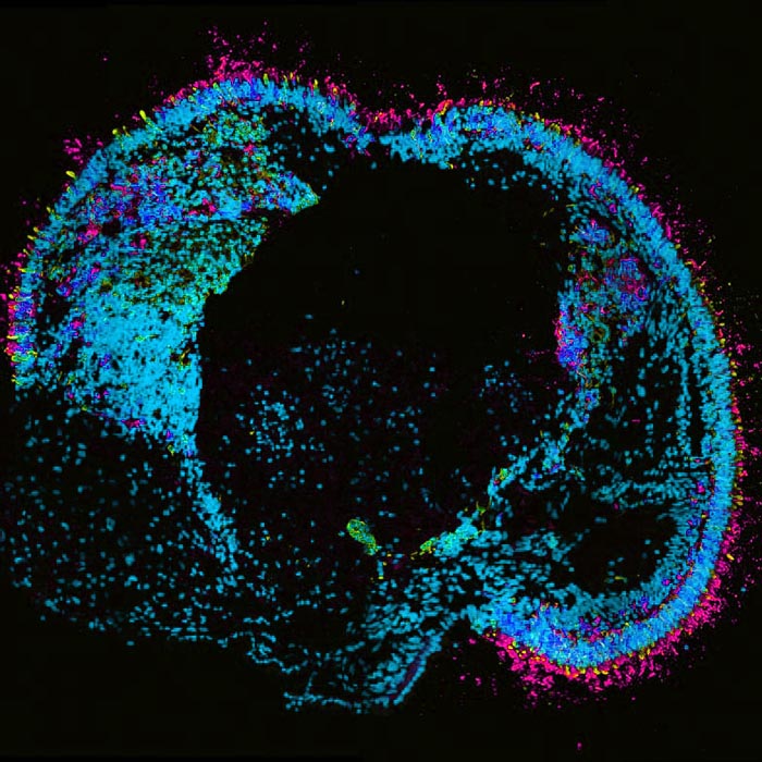 rods and cones in an organoid