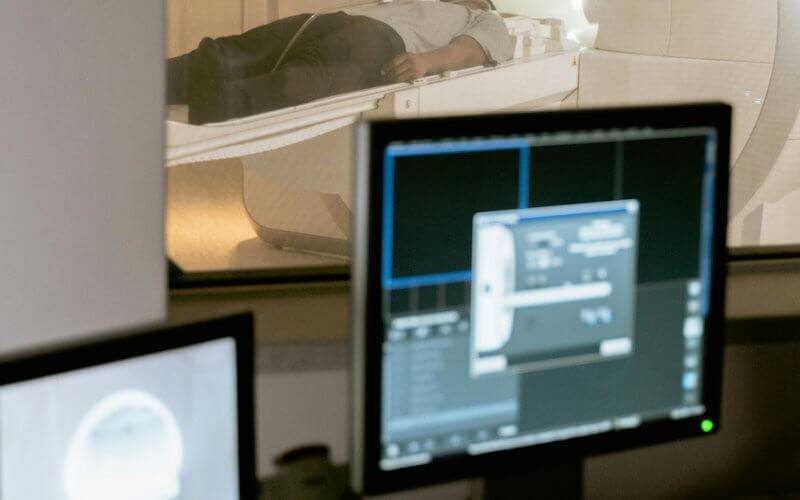 A person on an MRI machine and the monitors showing the imaging