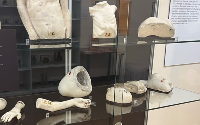 Casts from the UCL Pathology Collections, on glass shelves