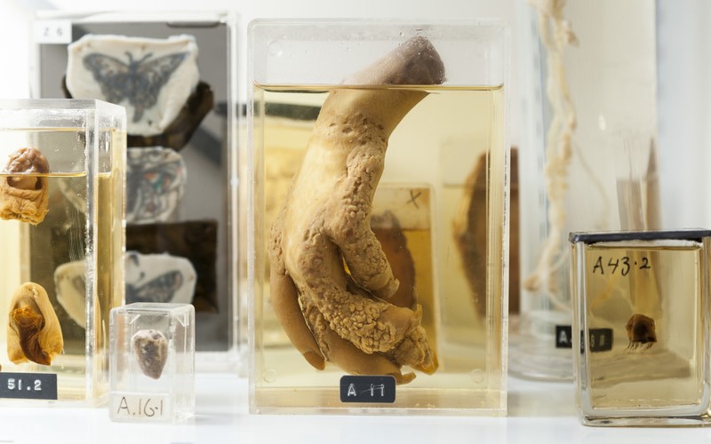 Items on display in the UCL Pathology Museum