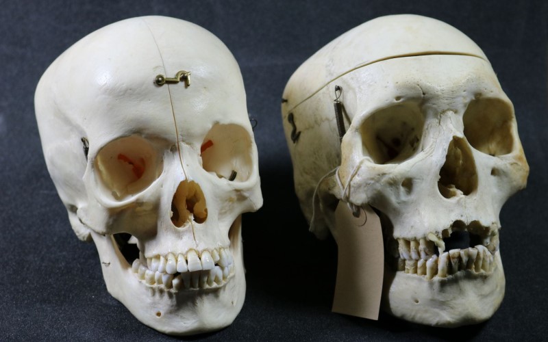 A pair of skulls