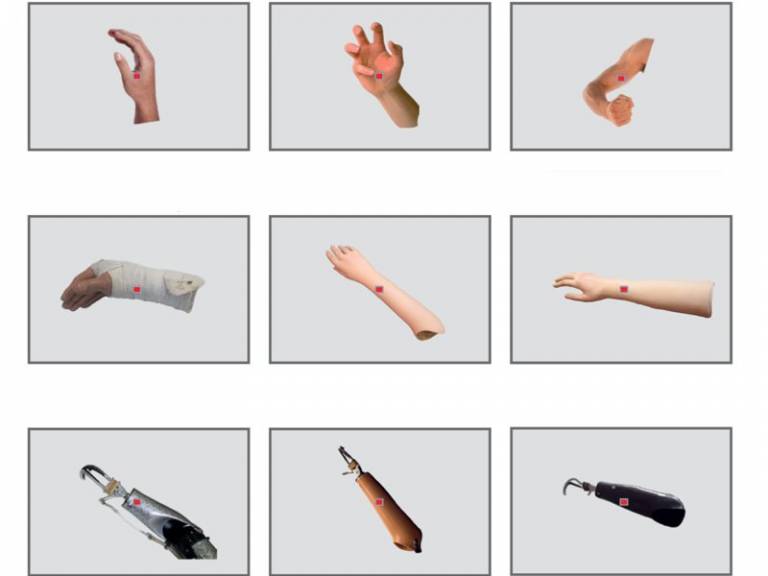 types of prosthetic arms