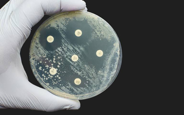 petri dish