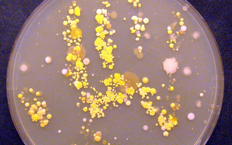 Petri dish showing bacteria