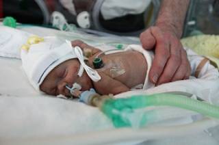 Image of premature baby